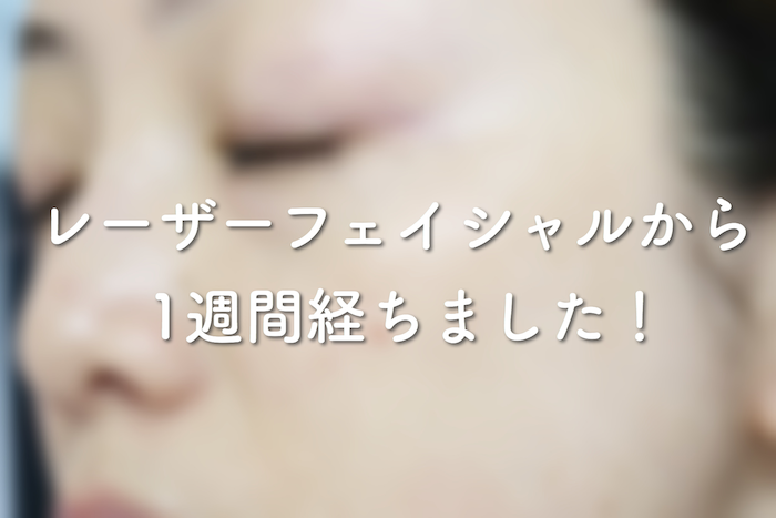 レーザーフェイシャルから1週間経ちました